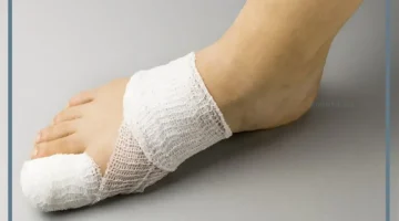 الجرح في الرجل