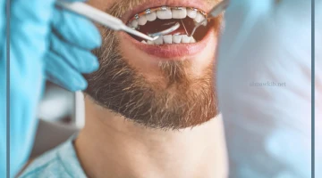 تفسير حلم خلع الاسنان