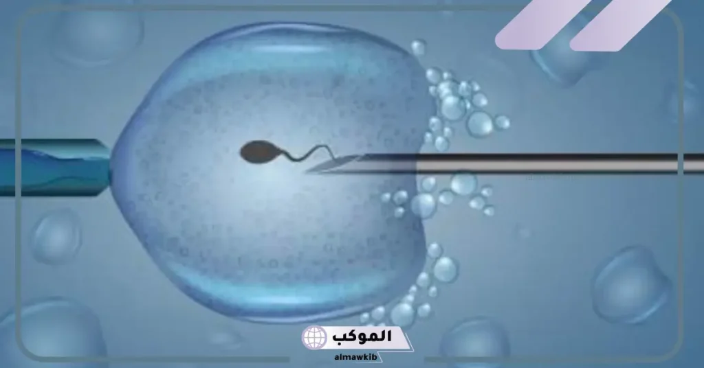 كيفية تحديد تكلفة الحقن المجهري في سليمان الحبيب