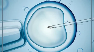 تكلفة الحقن المجهري