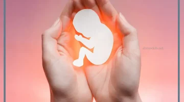 حلم الاجهاض