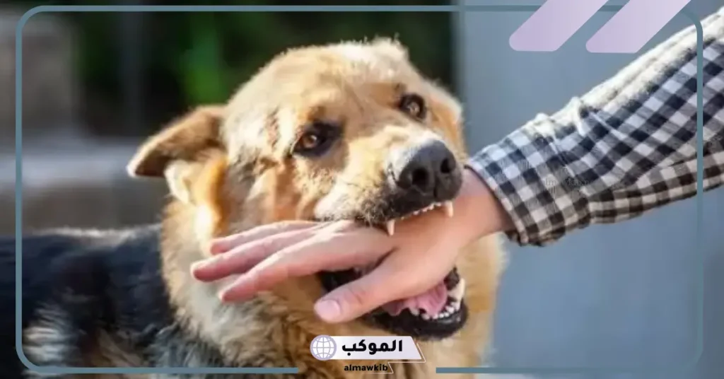 تفسير حلم عض الكلاب في الرجل