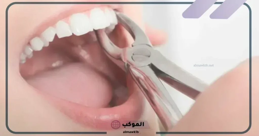 تفسير حلم تسوس الاسنان المطلقة 