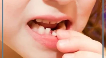 رؤية سقوط السن السفلي