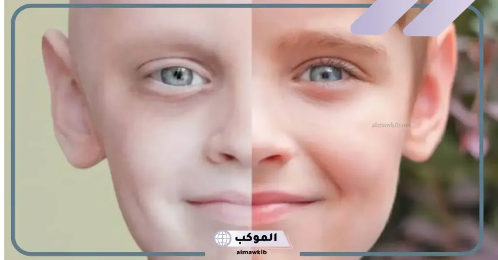 تفسير حلم مرض السرطان لابن سيرين