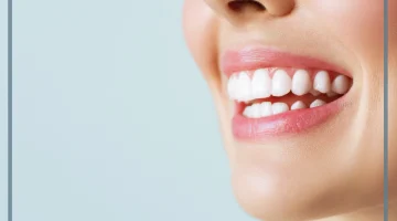 زراعة الأسنان