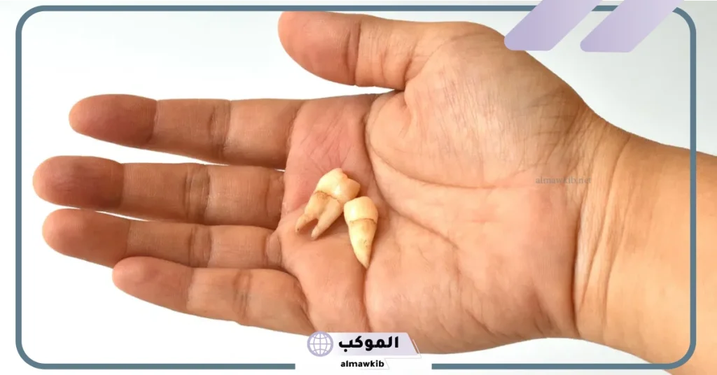 تفسير حلم كسر جزء من السن العلوي