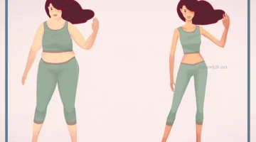 شفط الدهون من الجسم