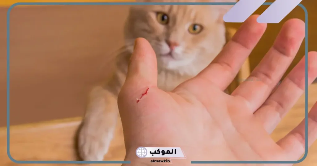تفسير حلم عضة القطة في اليد اليمنى