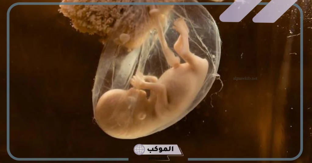 عدم ظهور كيس الحمل بالسونار البطني 