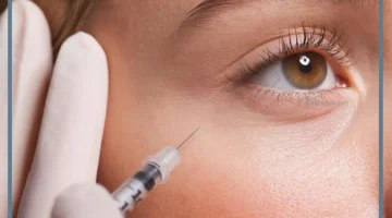 أفضل أنواع حقن الفيلر تحت العين
