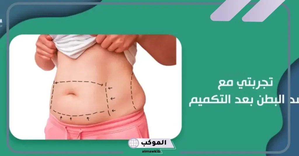 تجربتي مع عملية شد البطن بالمراحل والنتيجة النهائية 5 هل عملية شد البطن تسبب الوفاة؟