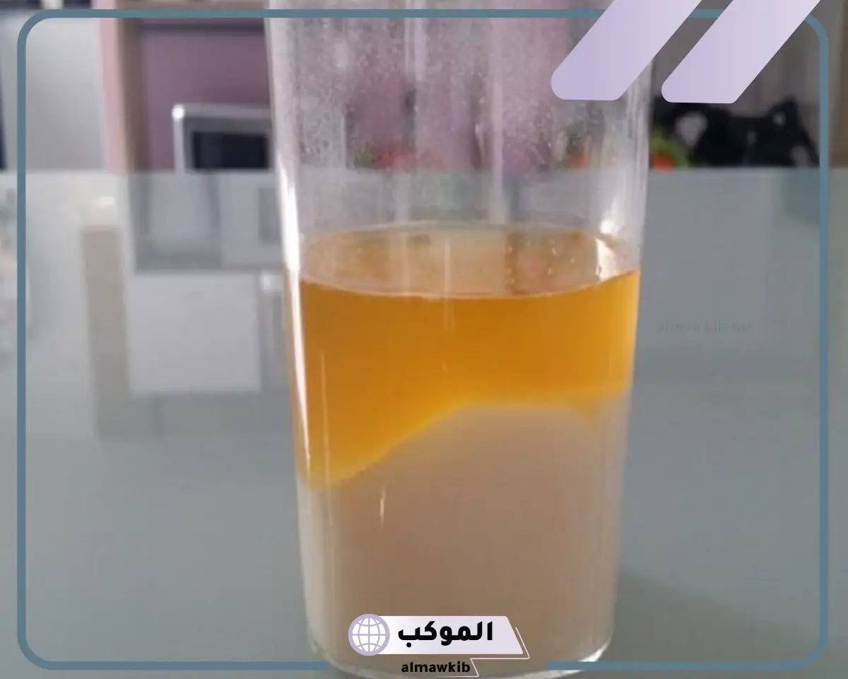 تجربتي مع اختبار الحمل بالملح وطريقة إجراء الاختبار