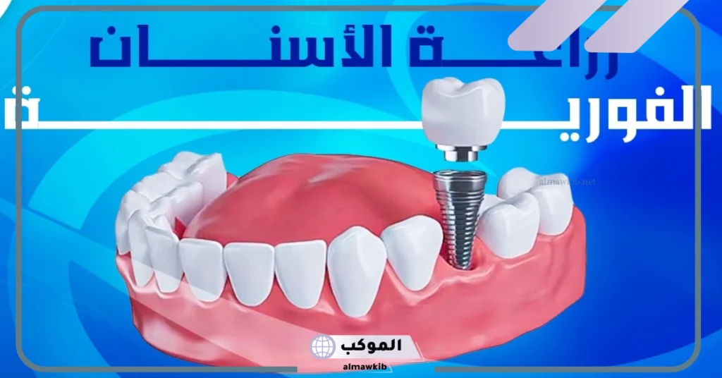 انا خايفه من زراعة الاسنان
