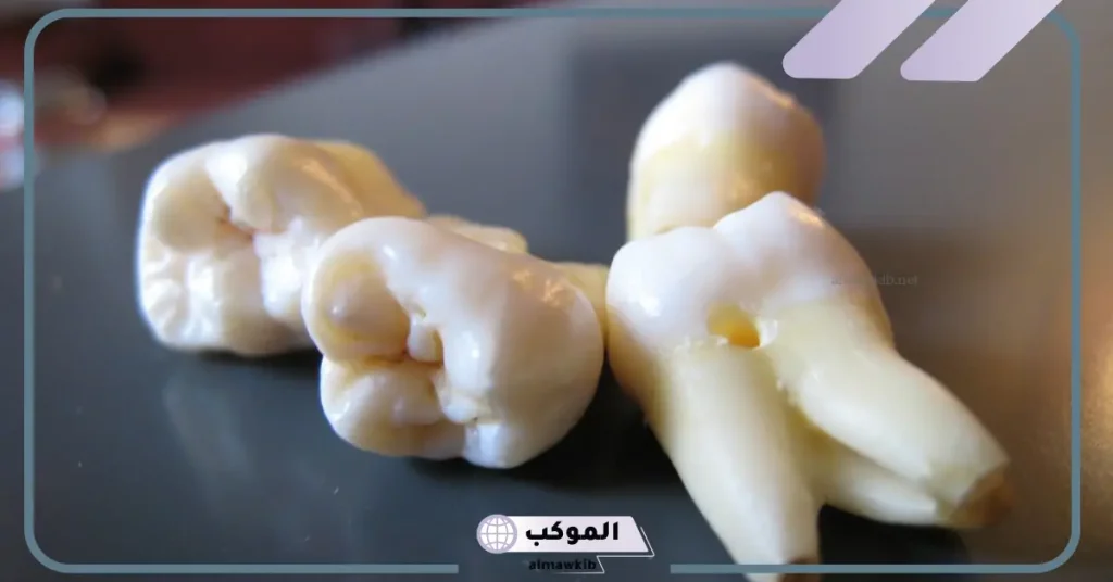 ما تأويل رؤية الاضراس العلوية