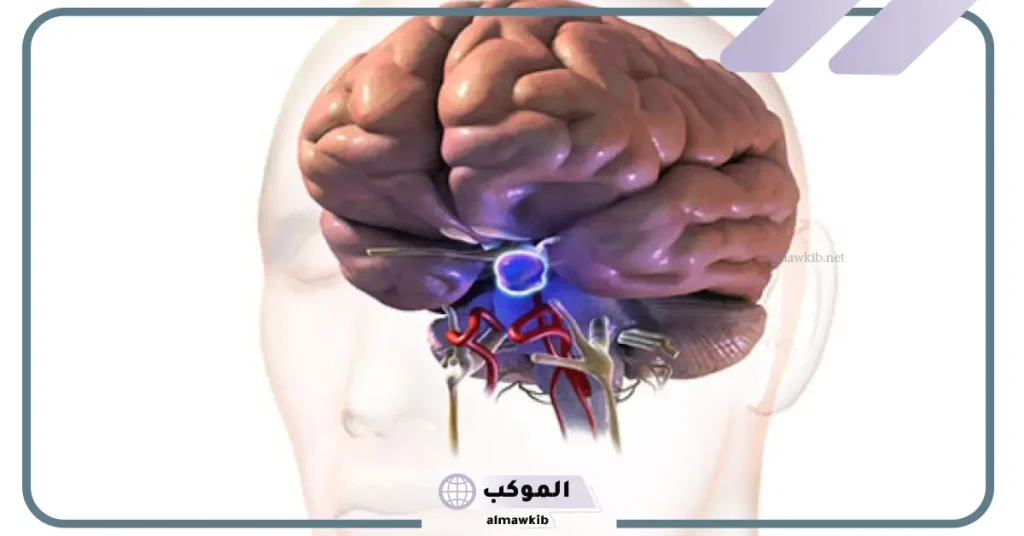 تجربتي مع ورم الدماغ وطرق العلاج 5 نسبة الشفاء من ورم الدماغ