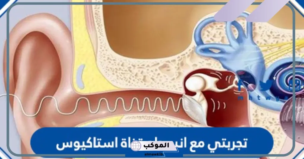 تجربتي مع انسداد قناة استاكيوس وعدم التهويه 5 تمارين فتح قناة استاكيوس