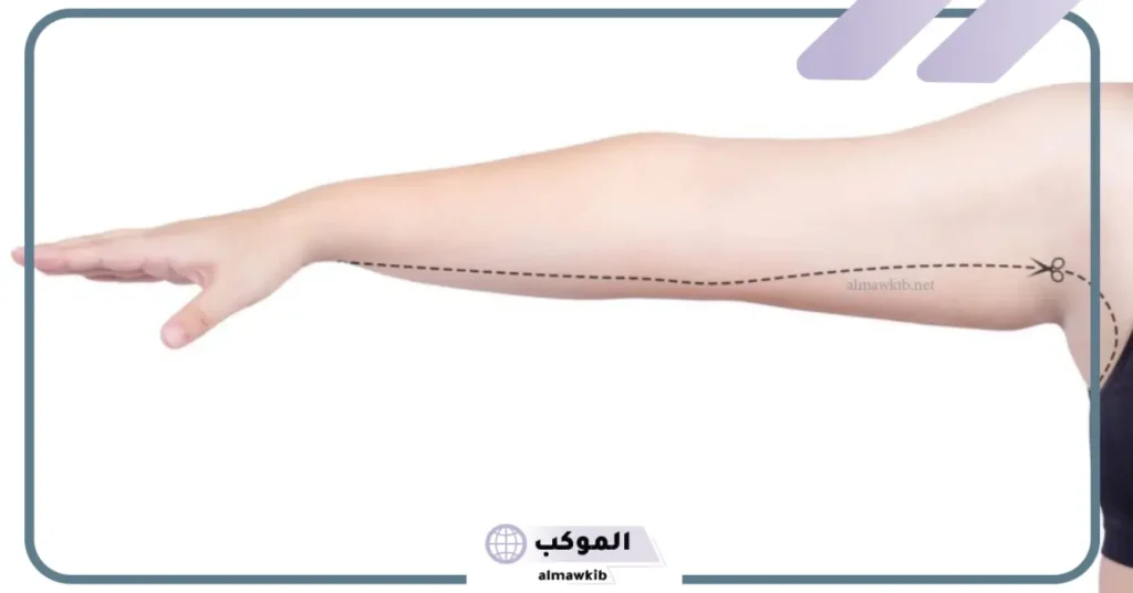 تجربتي مع تنحيف الزنود في أسبوع والنتيجة 5 أسباب كبر الزنود