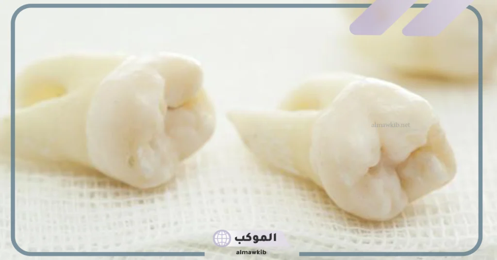 تفسير حلم خلع الضرس باليد 