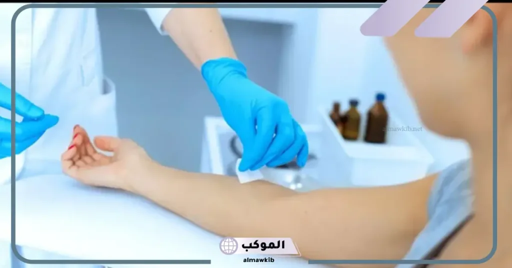 تجربتي مع الفصد وأبرز الأمراض التي يعالجها 6 طريقة الفصد