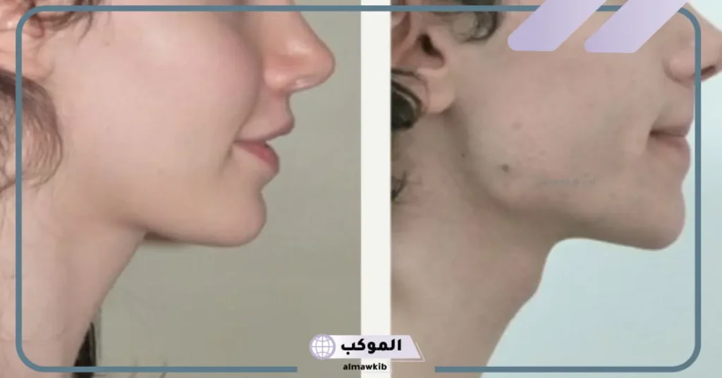 هل عملية الفك تغير الشكل؟