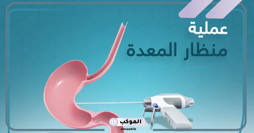 بديل منظار المعدة