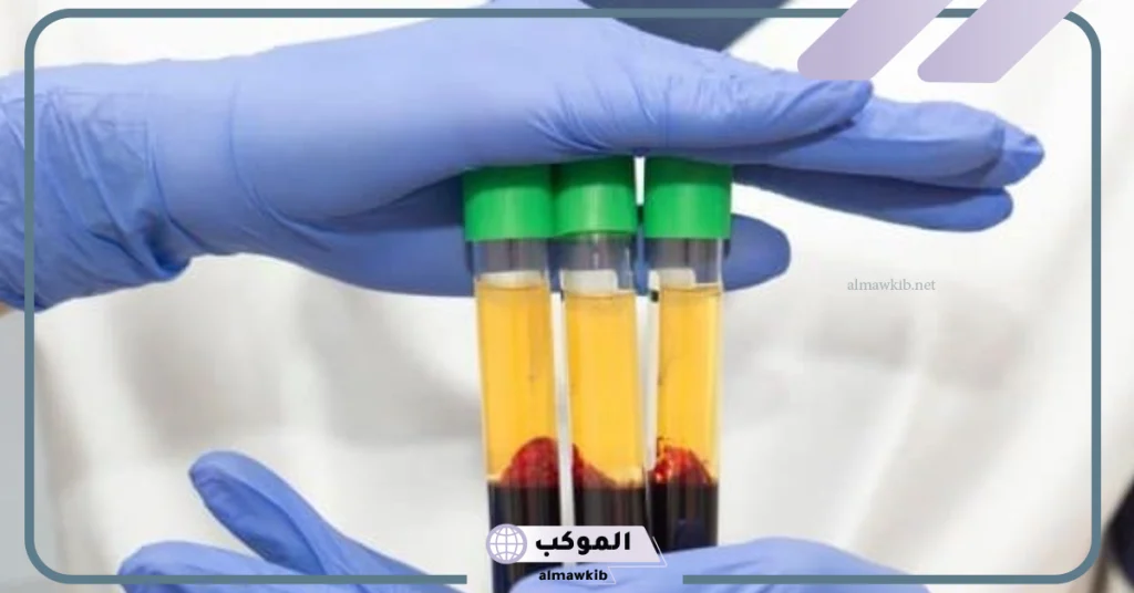 أضرار حقن البلازما للشعر  