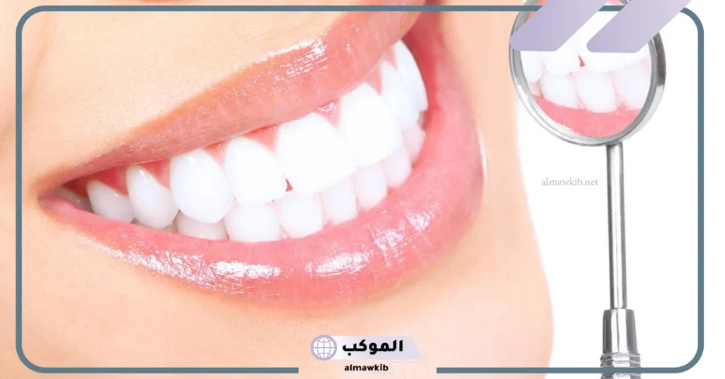 تجربتي مع عدسات الاسنان وأبرز النتائج بالفوائد والأضرار 6 تجربتي مع اللومينير