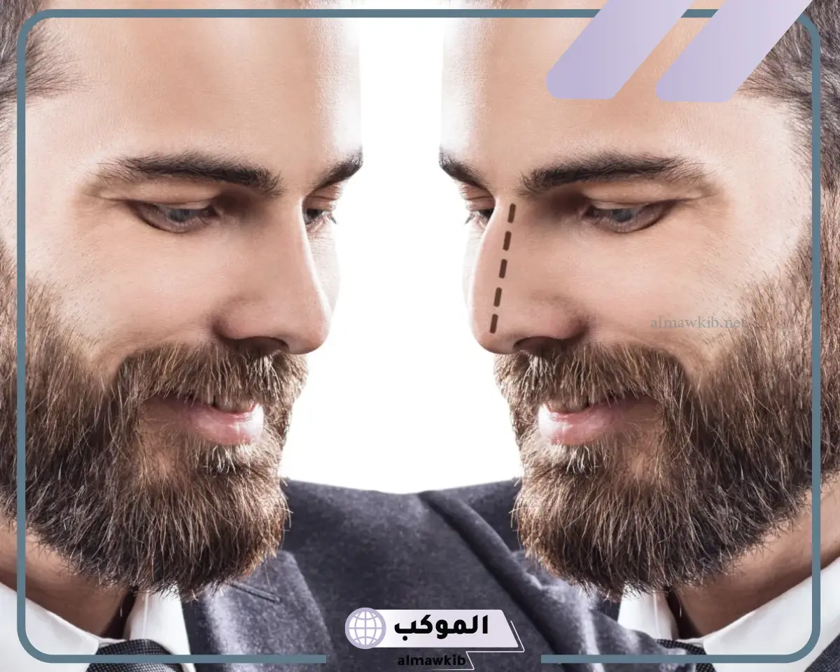 سر تجربتي مع عملية تجميل الانف