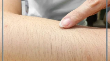 تفسير شعر الذراع