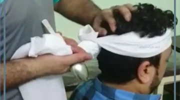 تنسيم الرأس