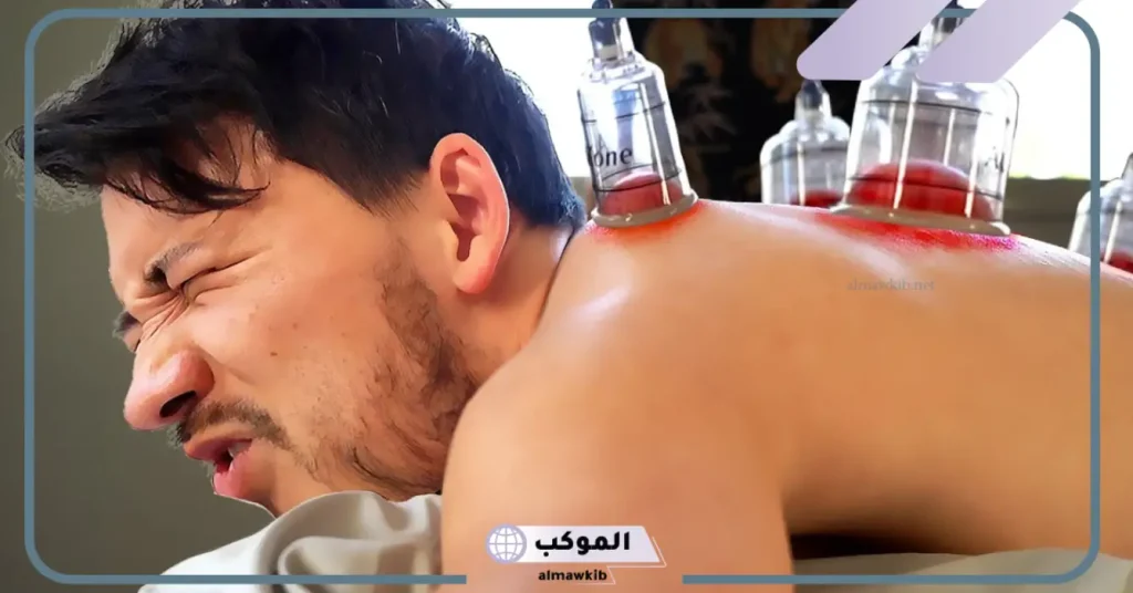 تجربتي مع الحجامة للعين بقدرة الله تعالى .. علامات خروج العين بالحجامة 5 فوائد الحجامة للعين والحسد