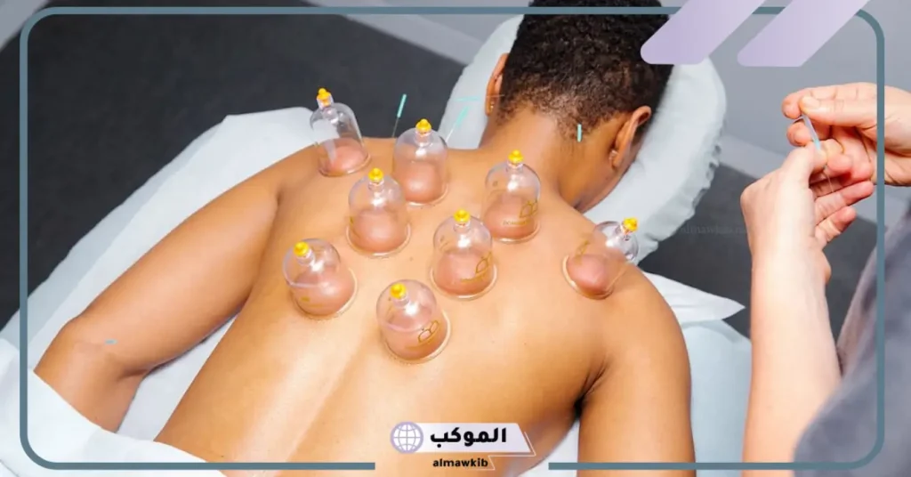 تجربتي مع الحجامة للعين بقدرة الله تعالى .. علامات خروج العين بالحجامة 6 علامات خروج العين بالحجامة