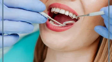 خلع الضرس في الحلم