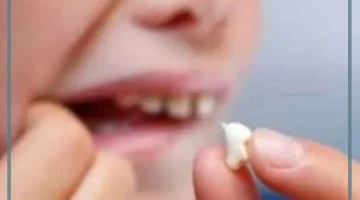 خلع الضرس في المنام