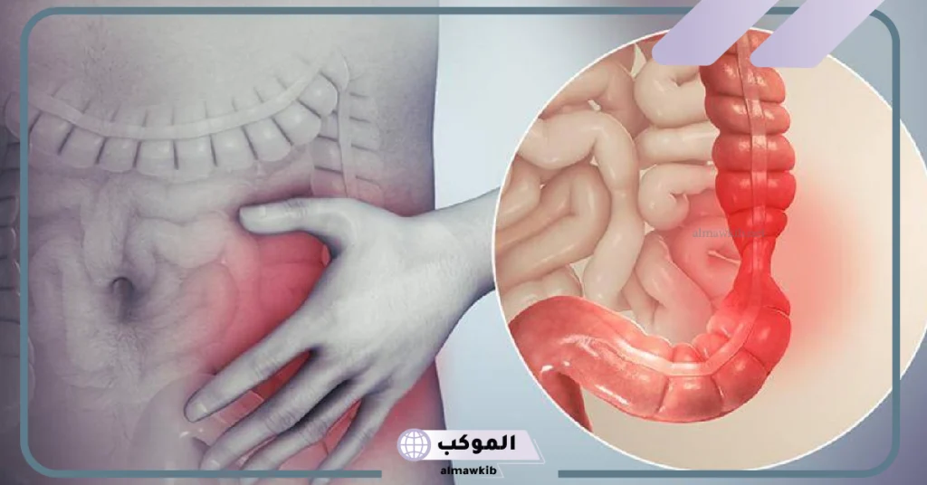 تجربتي مع حبوب dulcolax للإمساك وعلاجه 6 حبوب Dulcolax للقولون العصبي