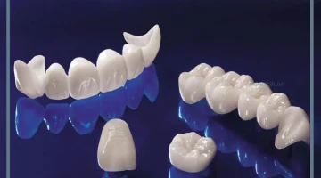 رؤية الضرس في المنام