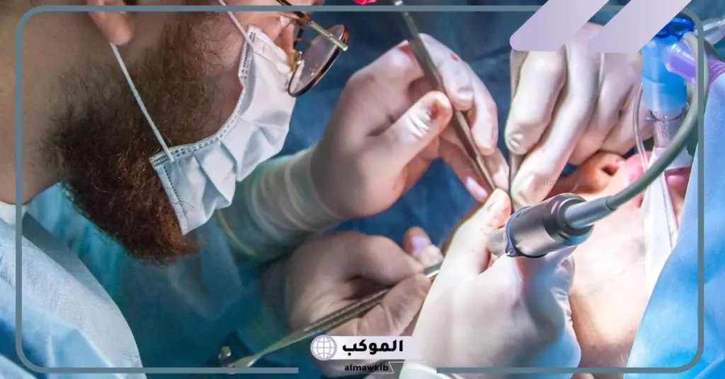 عيوب زراعة العدسات