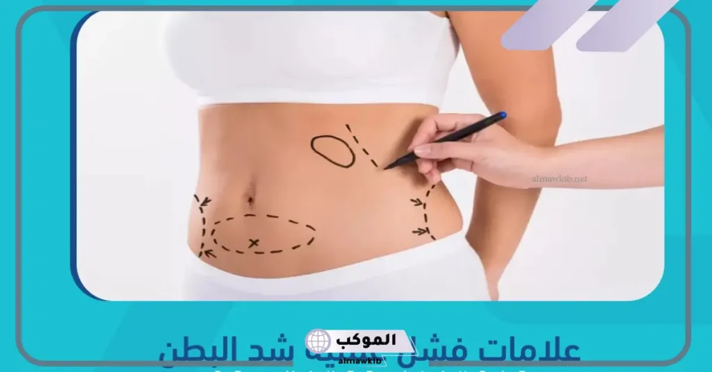 تجربتي مع عملية شد البطن بالمراحل والنتيجة النهائية 6 مدة الشفاء من عملية شد البطن