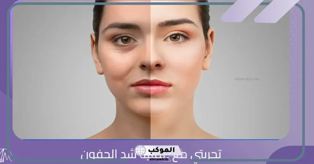 تجربتي مع عملية شد الجفون وأحدث طرق العلاج 6 أضرار شد الجفون بالليزر