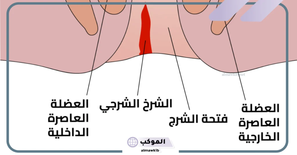 علاج الشرخ في المنزل  
