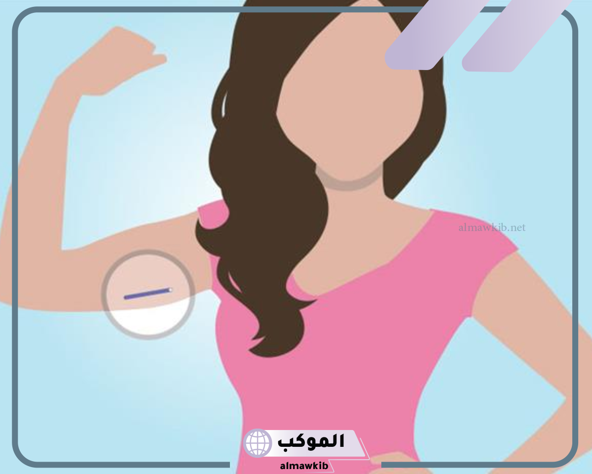 تجربتي مع شريحة منع الحمل .. المميزات والعيوب
