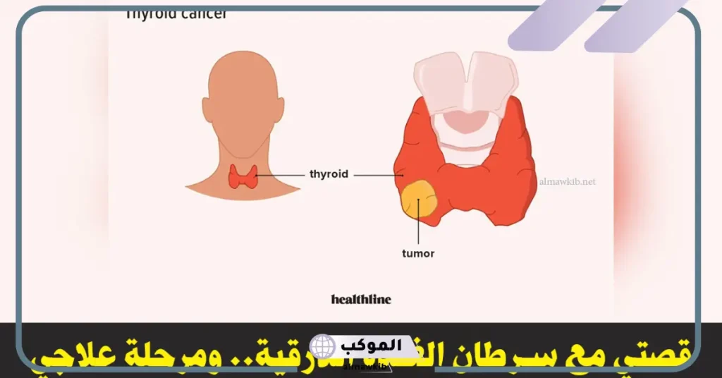تجربتي مع عقد الغدة الدرقية بالأعراض والأسباب 5 هل تختفي عقد الغدة الدرقية