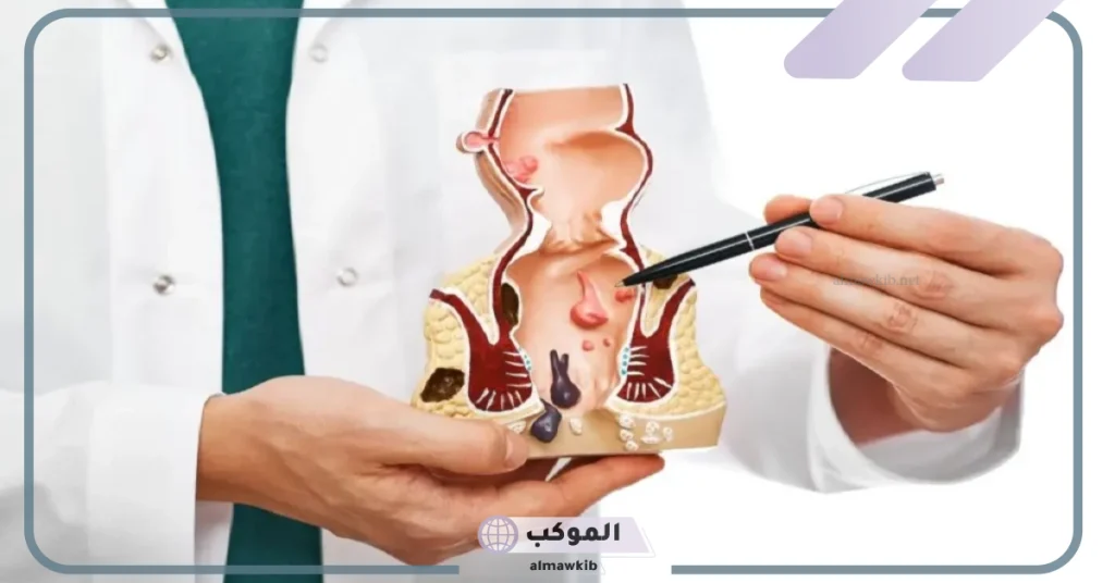 تجربتي مع الدكتور حسن نصر لعلاج البواسير والشرخ 6 الدكتور حسن نصر الناسور