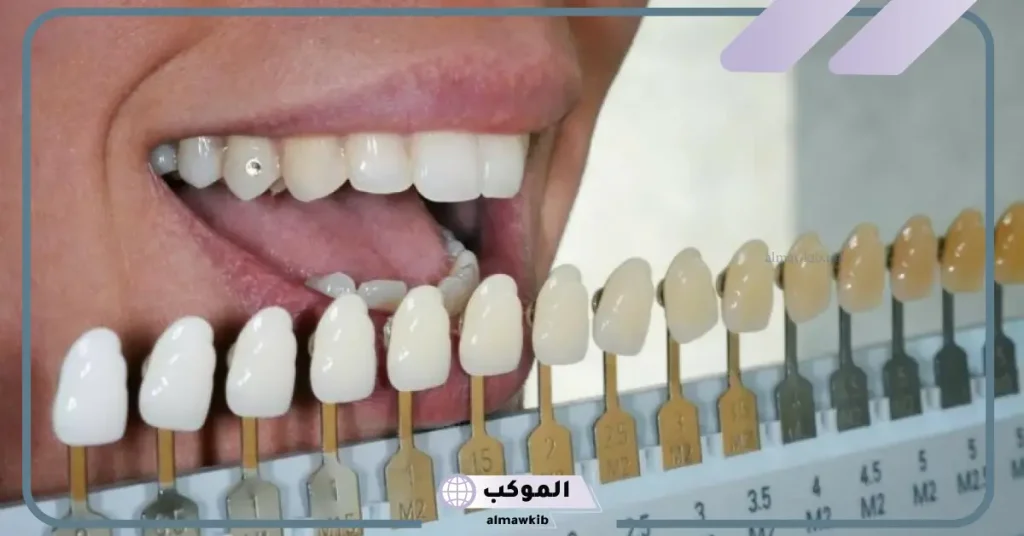 تجربتي مع تركيبات الزيركون بالاستخدامات والفوائد 6 ألم الأسنان بعد تركيب الزيركون