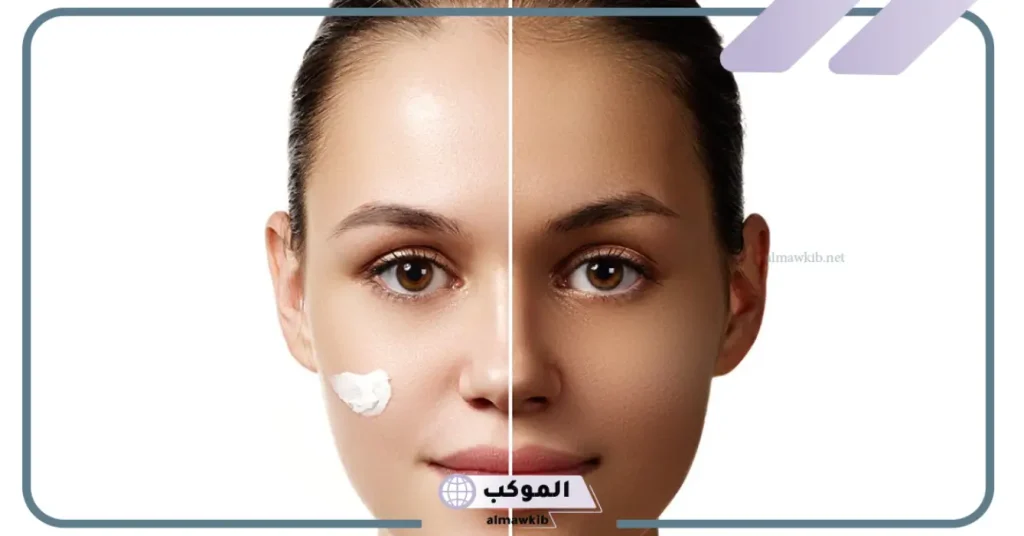 كريم افوتين اي للتبييض