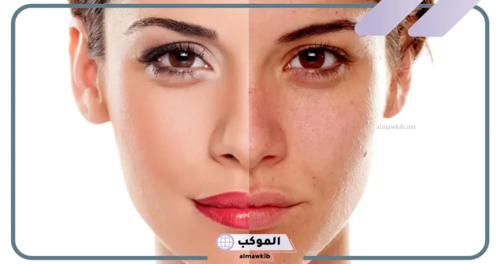 تجربتي مع كريم افوكوين للوجه لعلاج الكلف والبقع الداكنة 5 تجربتي مع كريم افوكوين للكلف