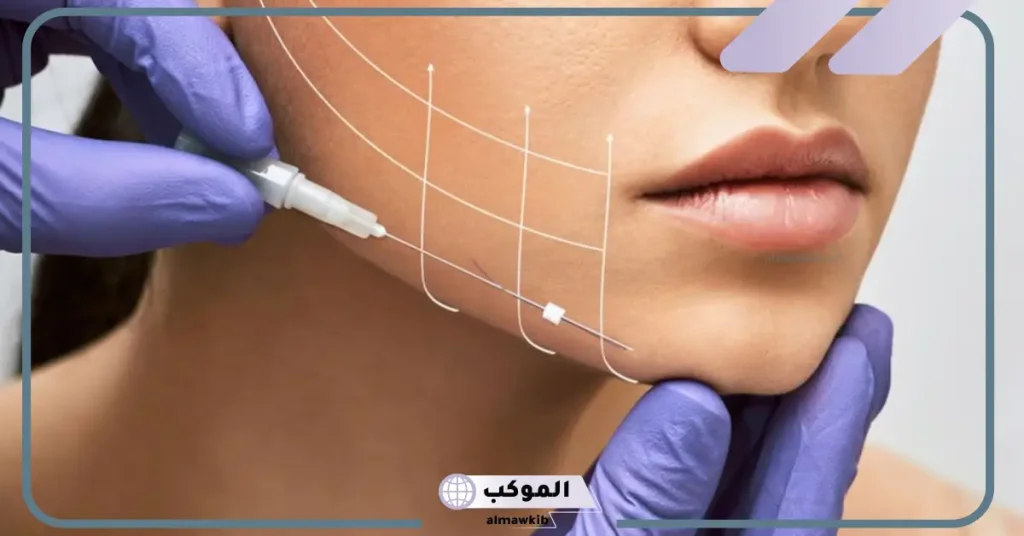 الممنوعات بعد خيوط الوجه