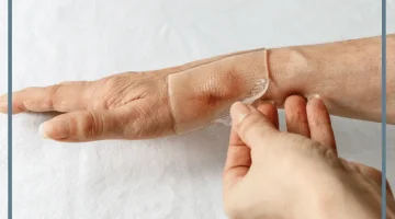 لصقات السيليكون