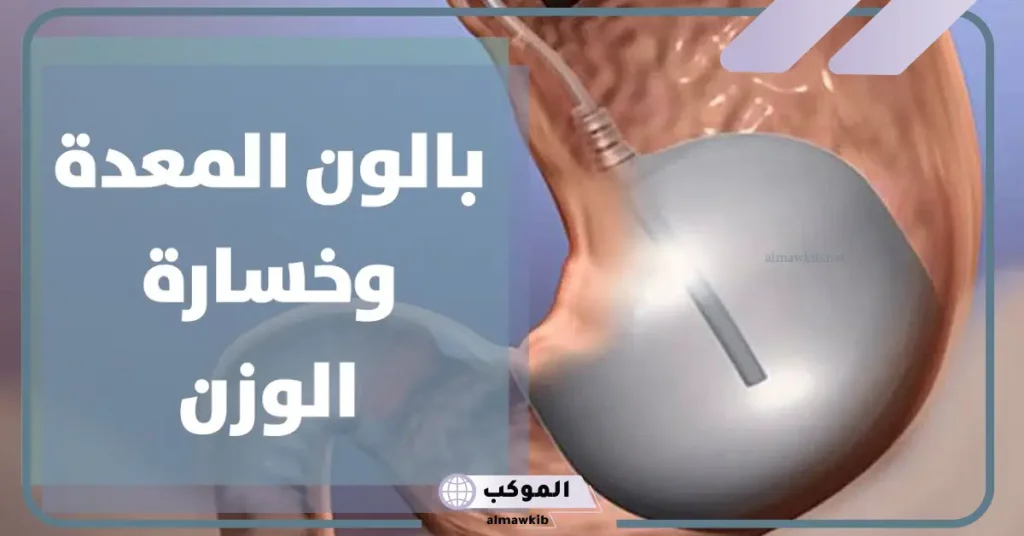 علامات انفجار بالون المعدة